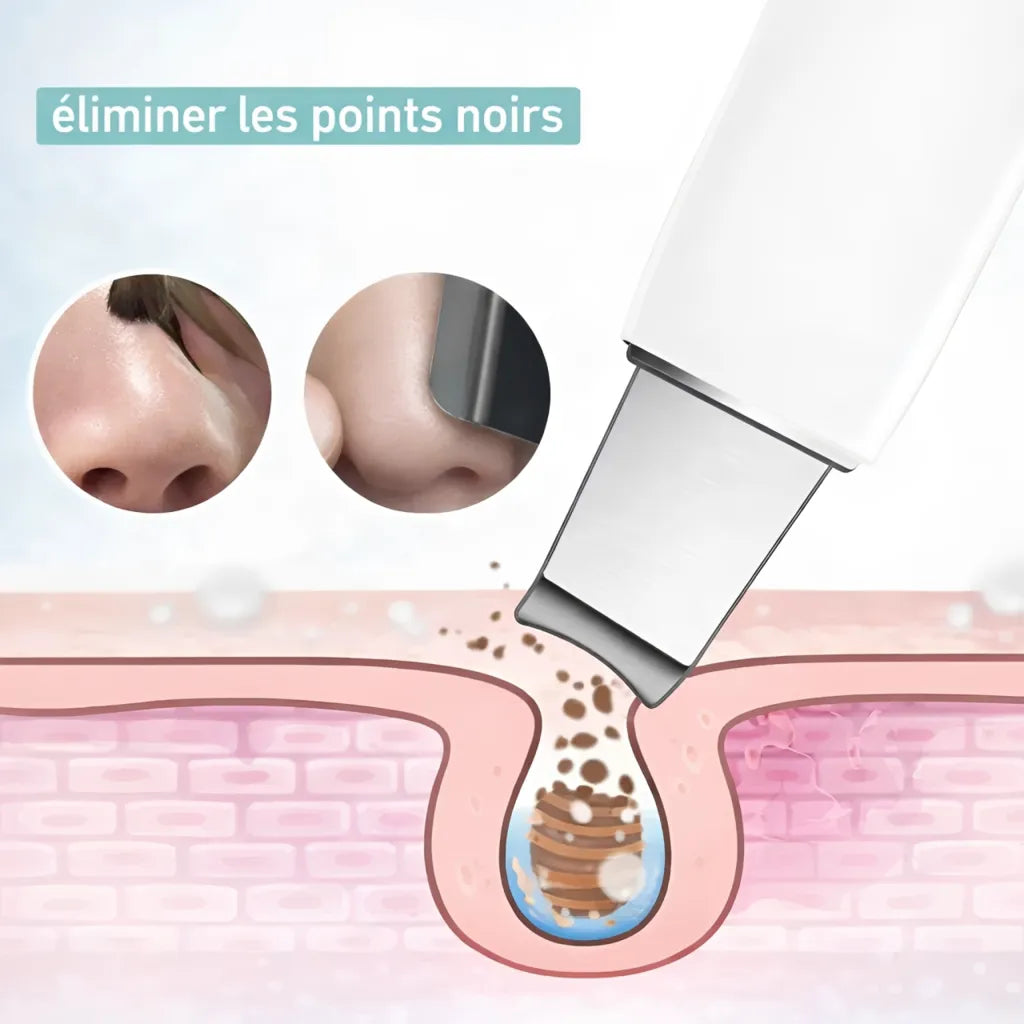 Nettoyeur de pores ultrasonique IceRelief — solution contre rides, acné, points noirs, peau grasse, gros pores et cellules mortes